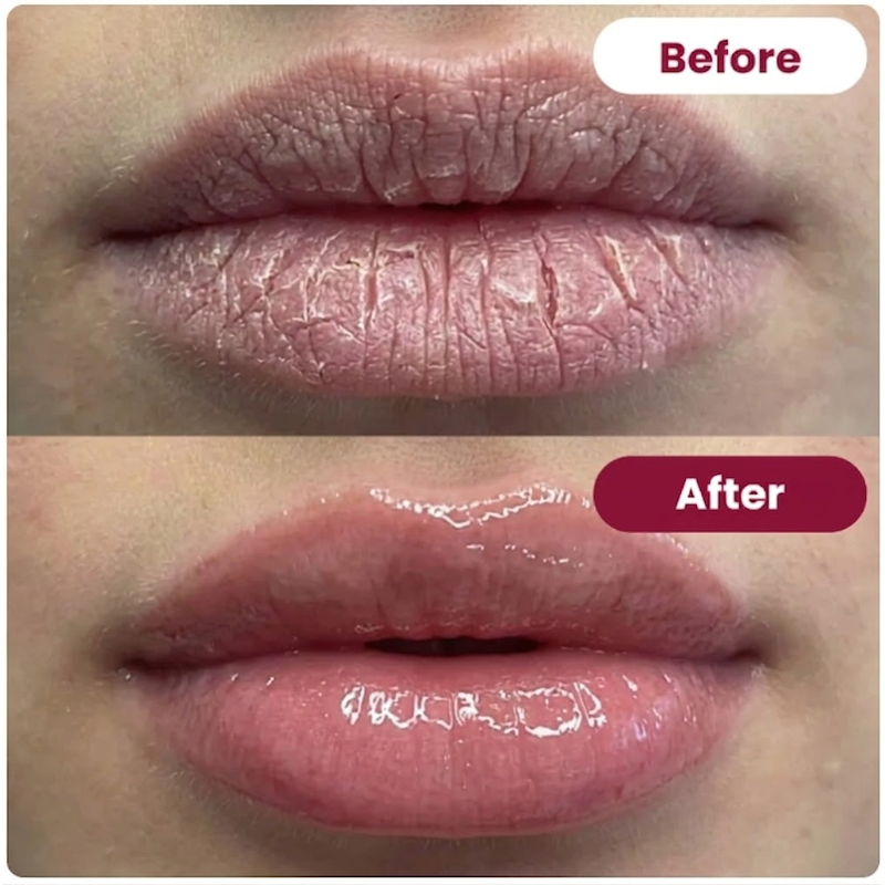 Sultry Lips Mouth Tape – Collagen Moisturizing Plump Lip Patches