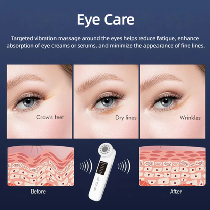 Radiance 7-in-1 LED Red Light, EMS, Ultrasonic, Ice Cooling, Glass Glow Beauty Device