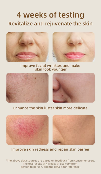 Radiance Face - Pro LED Red Light Therapy Mask