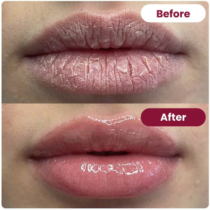 Sultry Lips Mouth Tape – Collagen Moisturizing Plump Lip Patches